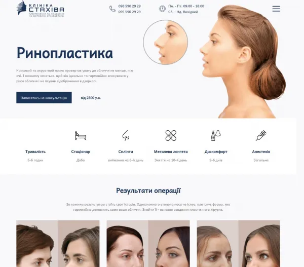 «Клініка Стахіва – Ринопластика» — пластична хірургія носа в Тернополі